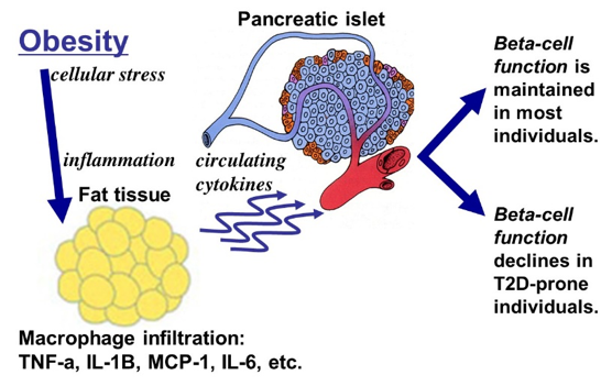 Macrophage infiltation